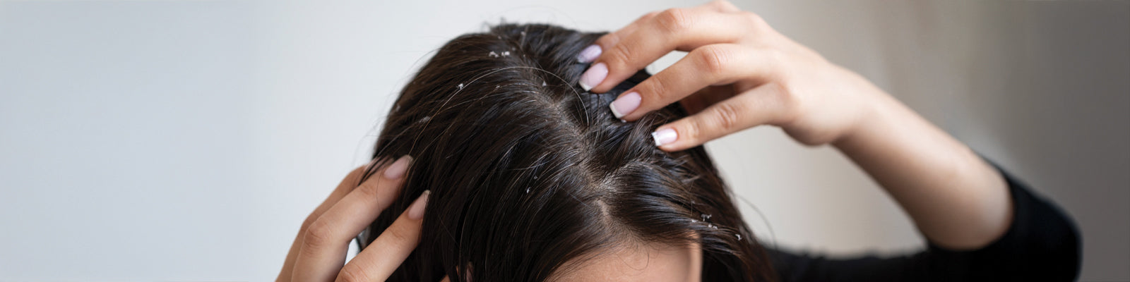 dandruff control regime