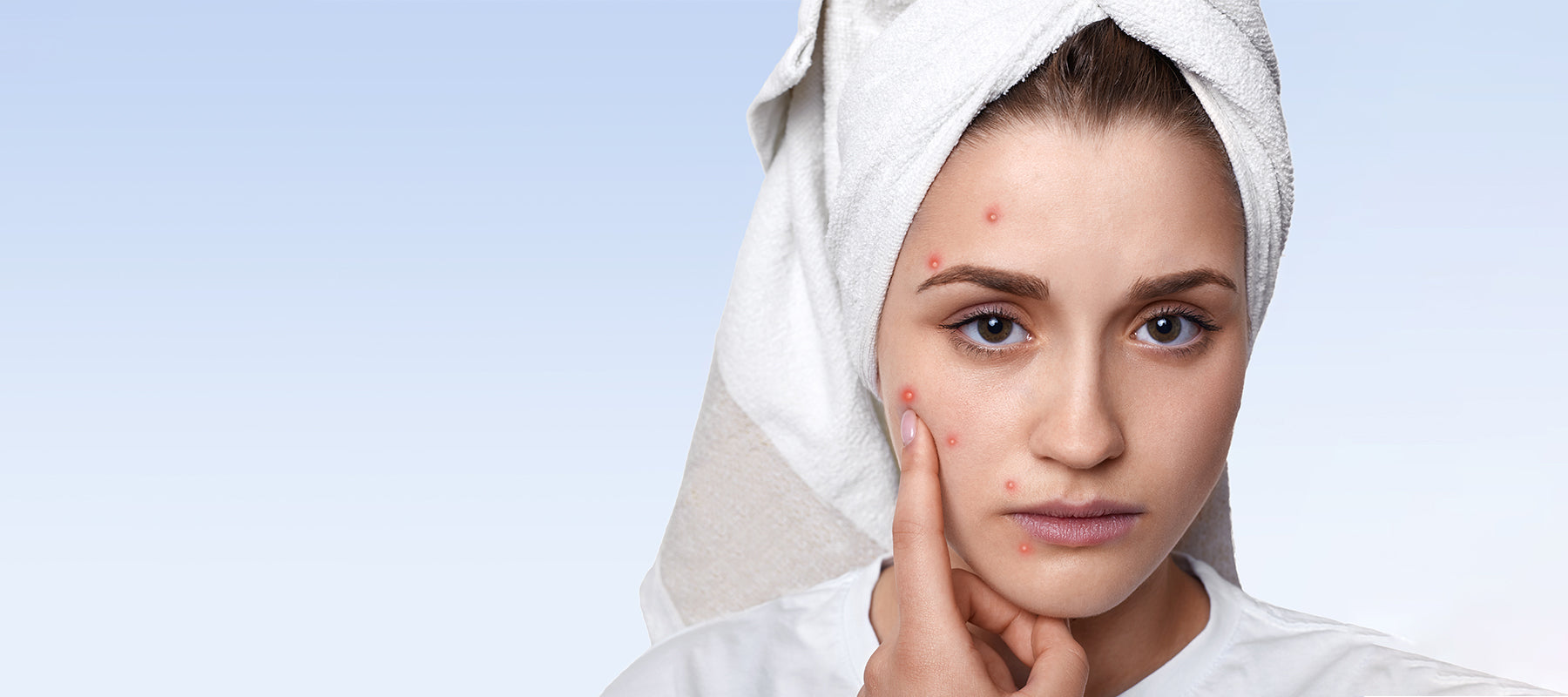 Curated visual reference: Easy Tips To Remove Acne Scars With Natural Products Photo Inspiration